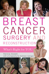 breast reconstruction stories