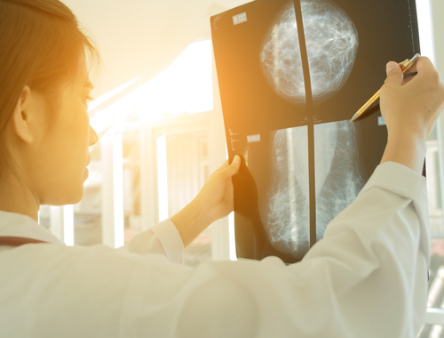 what is a mammogram like
