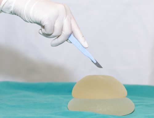 Breast Implants: Common Complications